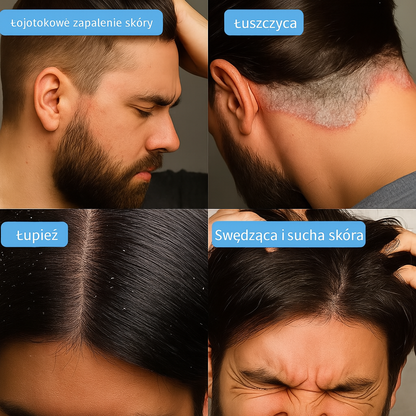 Maska przeciwłupieżowa