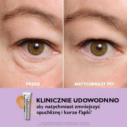 Peter Thomas Roth Instant FirmX – Natychmiastowy, tymczasowy ujędrniacz skóry wokół oczu