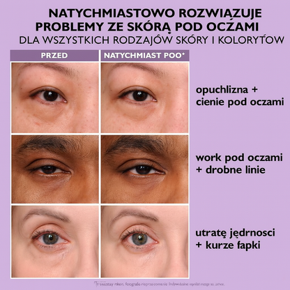 Peter Thomas Roth Instant FirmX – Natychmiastowy, tymczasowy ujędrniacz skóry wokół oczu