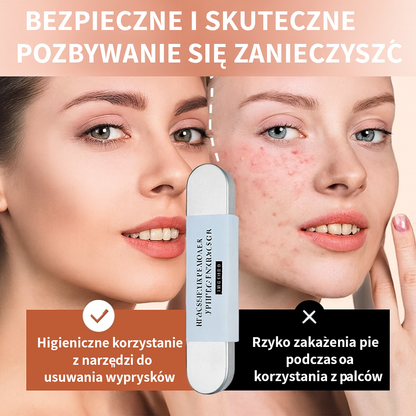 Zestaw ze stali nierdzewnej do usuwania wągrów