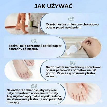 FungalPatch – Intensywny zestaw do pielęgnacji paznokci – Samoprzylepne plastry przeciwgrzybicze